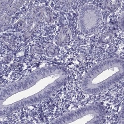 MAGEB1 Antibody, Novus Biologicals 0.1mL; Unlabeled:Antibodies, Polyclonal
