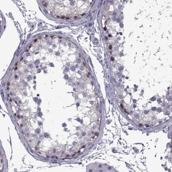 MAGEB1 Antibody, Novus Biologicals 0.1mL; Unlabeled:Antibodies, Polyclonal