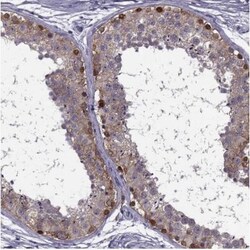 MAGEB1 Antibody, Novus Biologicals:Antibodies:Primary Antibodies