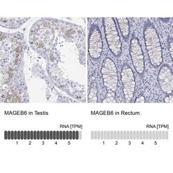 MAGEB6 Rabbit anti-Human, Polyclonal, Novus Biologicals 25 &mu;g; Unconjugated:Antibodies,