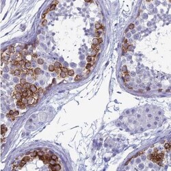 MAGEB6 Antibody, Novus Biologicals 25 &mu;L | Buy Online | Novus Biologicals | Fisher Scientific