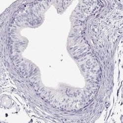MAGEC1 Antibody, Novus Biologicals:Antibodies:Primary Antibodies