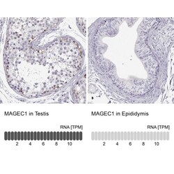 MAGEC1 Antibody, Novus Biologicals:Antibodies:Primary Antibodies