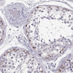 MAGEC1 Antibody, Novus Biologicals:Antibodies:Primary Antibodies