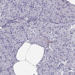 MAGEC1 Antibody, Novus Biologicals:Antibodies:Primary Antibodies
