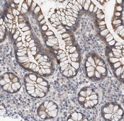 MAGEE2 Antibody, Novus Biologicals 0.1mL; Unlabeled:Antibodies, Polyclonal