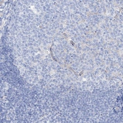 MAGI1 Antibody, Novus Biologicals:Antibodies:Primary Antibodies