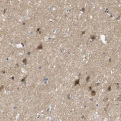 MAGI2 Antibody, Novus Biologicals 25 &mu;L; Unlabeled:Antibodies, Polyclonal