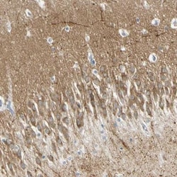 MAGI3 Antibody, Novus Biologicals:Antibodies:Primary Antibodies