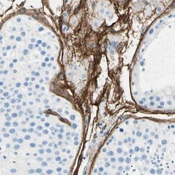 MAGP-2/MFAP5 Antibody, Novus Biologicals 0.1mL; Unlabeled:Antibodies, Polyclonal