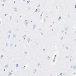 MAGP-2/MFAP5 Antibody, Novus Biologicals 0.1mL; Unlabeled:Antibodies, Polyclonal