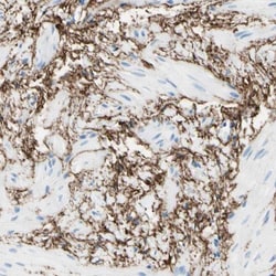 MAGP-2/MFAP5 Antibody, Novus Biologicals 0.1mL; Unlabeled:Antibodies, Polyclonal