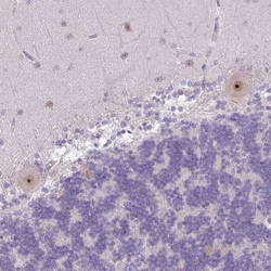 MAK16 Antibody, Novus Biologicals 0.1mL; Unlabeled:Antibodies, Polyclonal