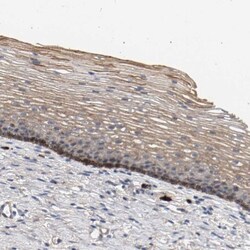 MAMDC2 Antibody, Novus Biologicals 0.1mL; Unlabeled:Antibodies, Polyclonal