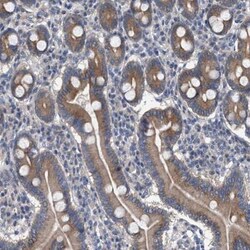 MAMDC2 Antibody, Novus Biologicals 0.1mL; Unlabeled:Antibodies, Polyclonal