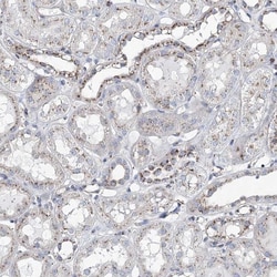 MAN1A2 Antibody, Novus Biologicals 25 &mu;L; Unlabeled:Antibodies, Polyclonal