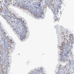 MAN1A2 Antibody, Novus Biologicals 25 &mu;L; Unlabeled:Antibodies, Polyclonal