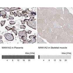 MAN1A2 Antibody, Novus Biologicals 25 &mu;L; Unlabeled:Antibodies, Polyclonal