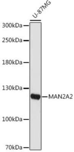 MAN2A2 Rabbit anti-Human, Polyclonal, Novus Biologicals:Antibodies:Primary