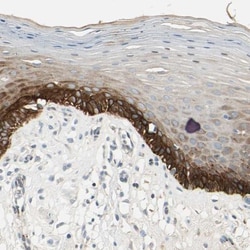 MANSC1 Antibody, Novus Biologicals 0.1mL; Unlabeled:Antibodies, Polyclonal