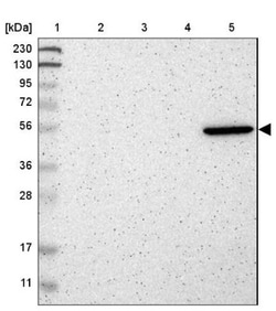 MANSC1 Antibody, Novus Biologicals 0.1mL; Unlabeled:Antibodies, Polyclonal