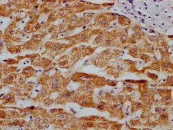 MAO-A Antibody (4C11), Novus Biologicals 100 &mu;g | Buy Online | Novus Biologicals | Fisher Scientific