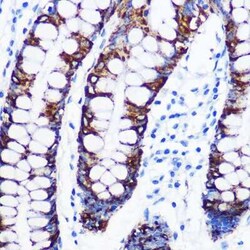 MAO-A Rabbit anti-Human, Mouse, Rat, Clone: 9U8P8, Novus Biologicals:Antibodies:Primary