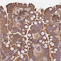 MAO-A Antibody, Novus Biologicals 25 &mu;L, Unlabeled:Antibodies, Polyclonal