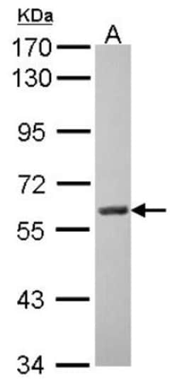 MAO-A Antibody, Novus Biologicals 0.1mL; Unlabeled:Antibodies, Polyclonal