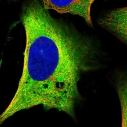 MAP1B Antibody, Novus Biologicals 25 &mu;L; Unlabeled:Antibodies, Polyclonal