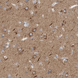 MAP1B Antibody, Novus Biologicals 25 &mu;L; Unlabeled:Antibodies, Polyclonal