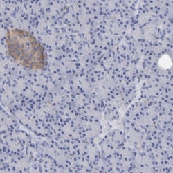 MAP1B Antibody, Novus Biologicals 25 &mu;L; Unlabeled:Antibodies, Polyclonal
