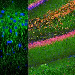 MAP2 Antibody (4H5), Novus Biologicals:Antibodies:Primary Antibodies
