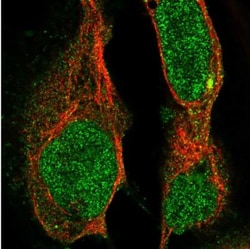 MAP3K13 Antibody, Novus Biologicals 25 &mu;L; Unlabeled:Antibodies, Polyclonal