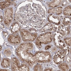 MAP3K13 Antibody, Novus Biologicals 25 &mu;L; Unlabeled:Antibodies, Polyclonal