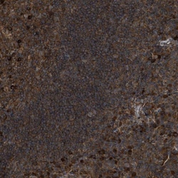 ATP6V1H Antibody, Novus Biologicals:Antibodies:Primary Antibodies