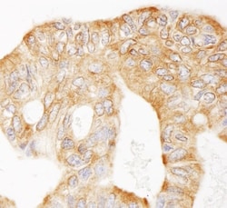 MAP4 Antibody, Novus Biologicals 0.1mL; Unlabeled:Antibodies, Polyclonal