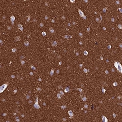 MAP6 Antibody, Novus Biologicals 25 &mu;L, Unlabeled:Antibodies, Polyclonal