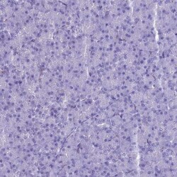 MAP6 Antibody, Novus Biologicals 25ul | Buy Online | Novus Biologicals | Fisher Scientific