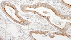 MAP7 Antibody, Novus Biologicals 0.1mL; Unlabeled:Antibodies, Polyclonal