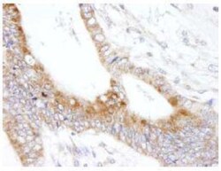 MAP7 Antibody, Novus Biologicals 0.1mL; Unlabeled:Antibodies, Polyclonal