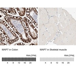 MAP7 Antibody, Novus Biologicals 0.1mL; Unlabeled:Antibodies, Polyclonal