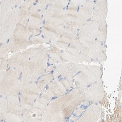 MAP7 Antibody, Novus Biologicals 0.1mL; Unlabeled:Antibodies, Polyclonal