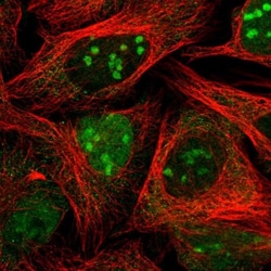 MAPKBP1 Antibody, Novus Biologicals 0.1mL; Unlabeled:Antibodies, Polyclonal