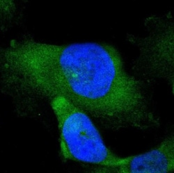MAPRE1 Antibody, Novus Biologicals 0.1mL; Unlabeled:Antibodies, Polyclonal