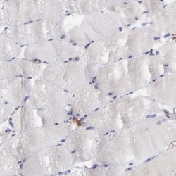 MAPRE1 Antibody, Novus Biologicals 0.1mL; Unlabeled:Antibodies, Polyclonal