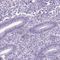 MARCH10 Antibody, Novus Biologicals 0.1mL; Unlabeled:Antibodies, Polyclonal