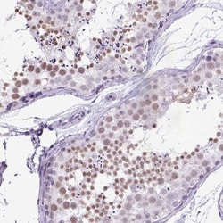 MARCH10 Antibody, Novus Biologicals 0.1mL; Unlabeled:Antibodies, Polyclonal