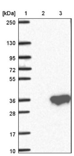 MARCH3 Antibody, Novus Biologicals 25ul | Buy Online | Novus Biologicals | Fisher Scientific