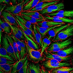 MARCKS Antibody, Novus Biologicals 0.1mL; Unlabeled:Antibodies, Polyclonal